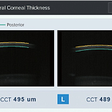 Бесконтактный тонометр HNT-1P (с пахиметром) Huvitz, Южная Корея (172460)