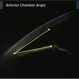 Бесконтактный тонометр HNT-1P (с пахиметром) Huvitz, Южная Корея (172460)