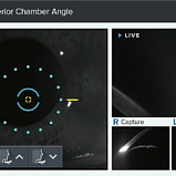 Бесконтактный тонометр HNT-1P (с пахиметром) Huvitz, Южная Корея (172460)